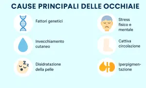 Cause occhiaie: genetica, invecchiamento, disidratazione, stress, cattiva circolazione, iperpigmentazione.