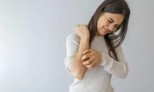 Donna con eruzione cutanea sul gomito che si gratta, cercando rimedi per prurito insopportabile.