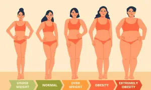 Cinque silhouette femminili mostrano diverse categorie di BMI, da sottopeso a obesità estrema. Un percorso visivo per chi desidera dimagrire in fretta.