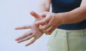 Mano che si gratta il palmo, un gesto che indica un forte prurito alle braccia.