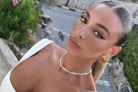 Chiara Frattesi, con un look elegante e un choker floreale, si gode una giornata all'aperto tra il verde e il sole.