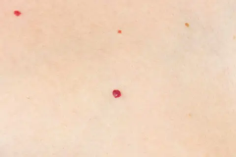 Pelle chiara con piccole macchie rosse, come rubini apparsi nei rossi all'improvviso, e una più scura.