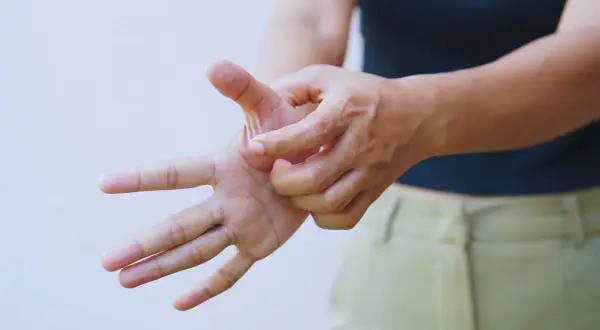 Mano che si gratta il palmo, un gesto che indica un forte prurito alle braccia.